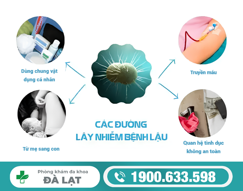 Hình ảnh minh họa